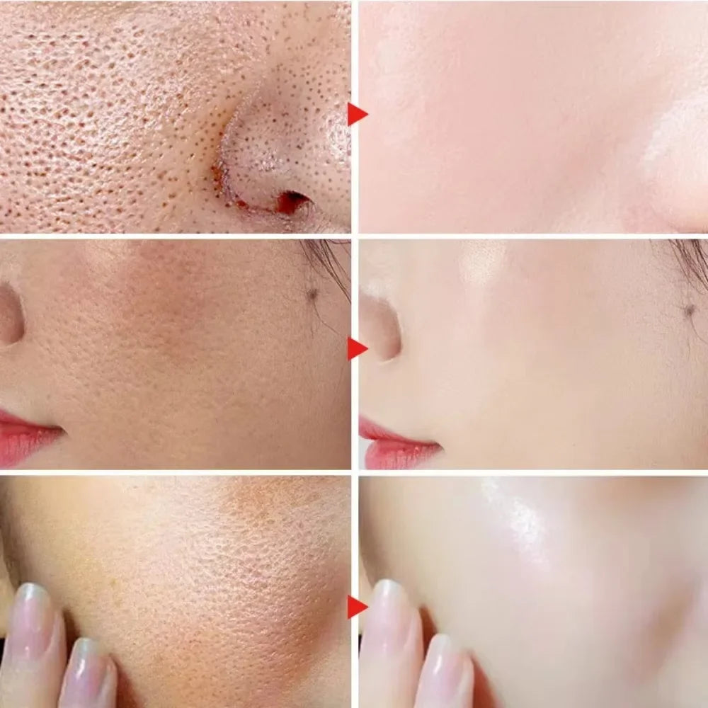 Lactic Acid Large Pores Removal Serum Pore Shrinking Minimizing Essence Moisturizing Firming Smooth Repair Korean Skin Care